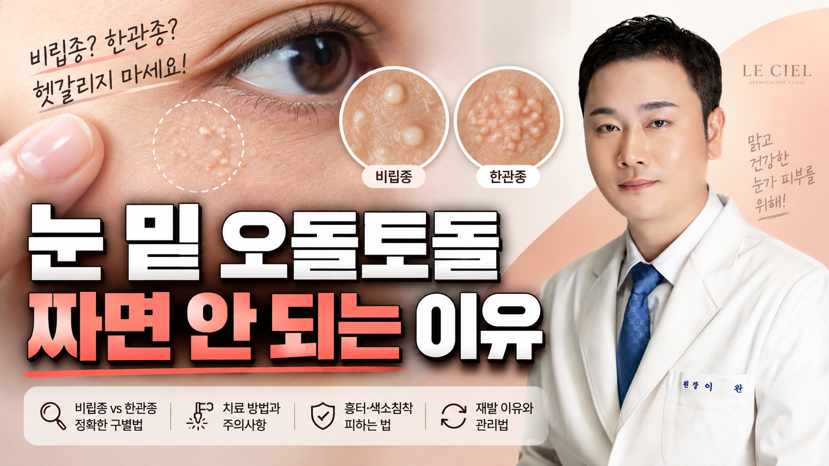 눈밑 오돌토돌, 비립종일까 한관종일까? 차이부터 치료·재발까지
